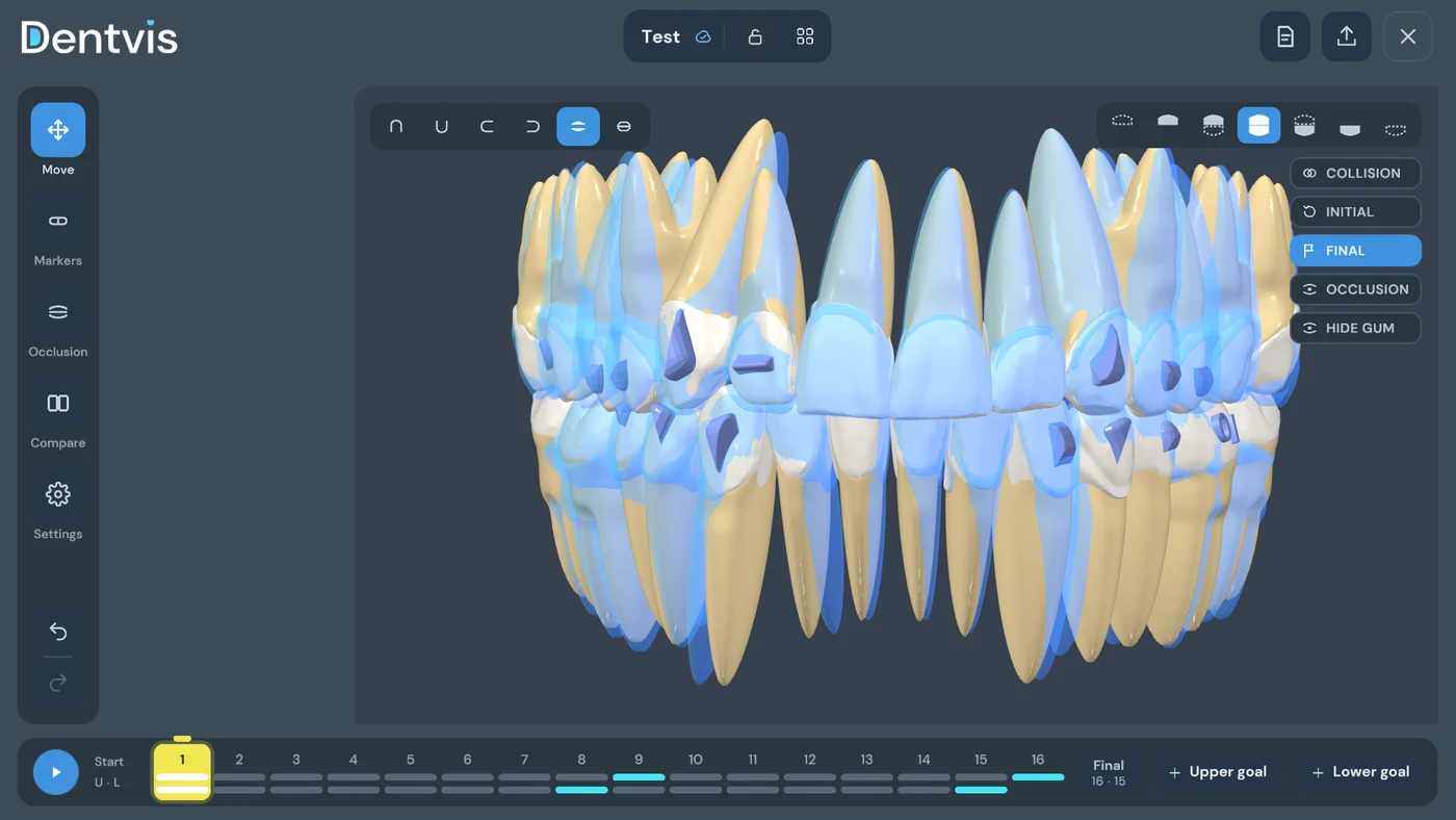 Final tooth positions shown semi-transparently in blue over the current step in DentVIS
