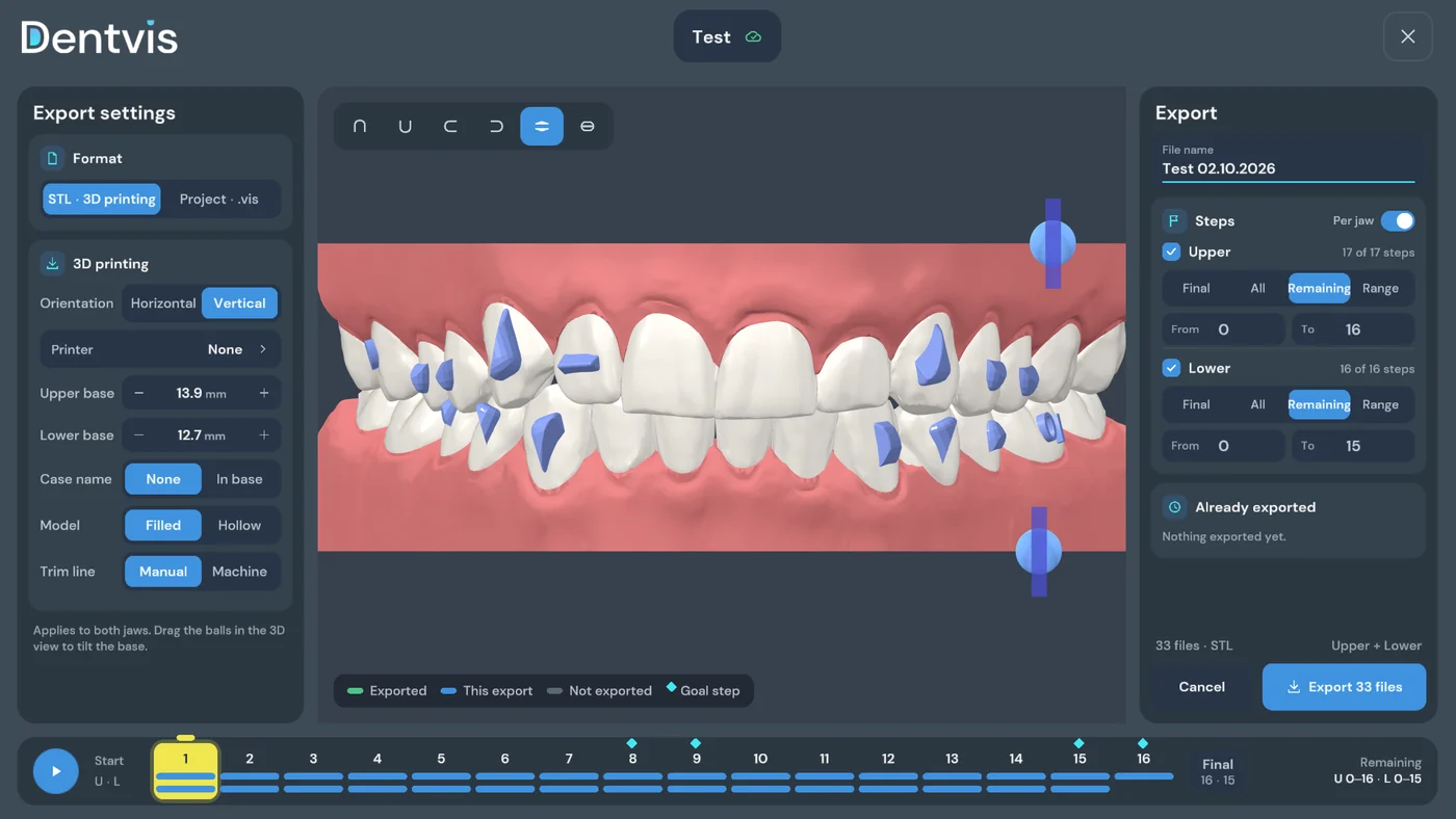 Export options for 3D printing in DentVIS