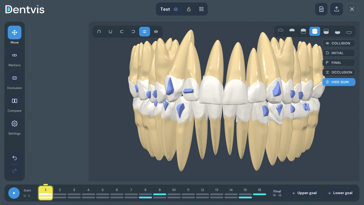 Individual teeth with schematic roots in DentVIS, gum hidden