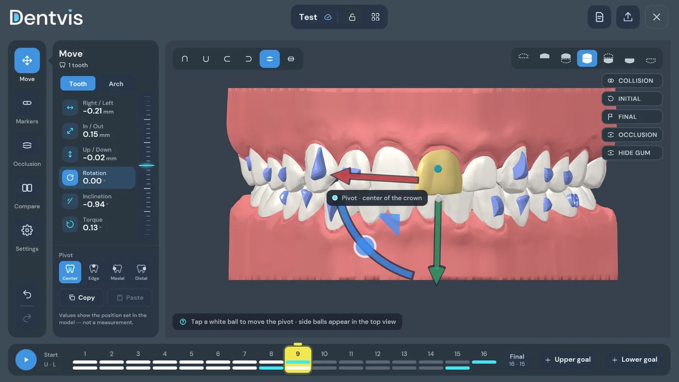 DentVIS — Virtual Setup of a dental arch with the step timeline