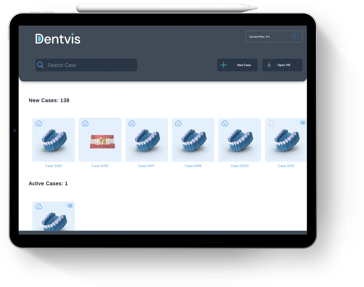 Case overview in DentVIS on iPad