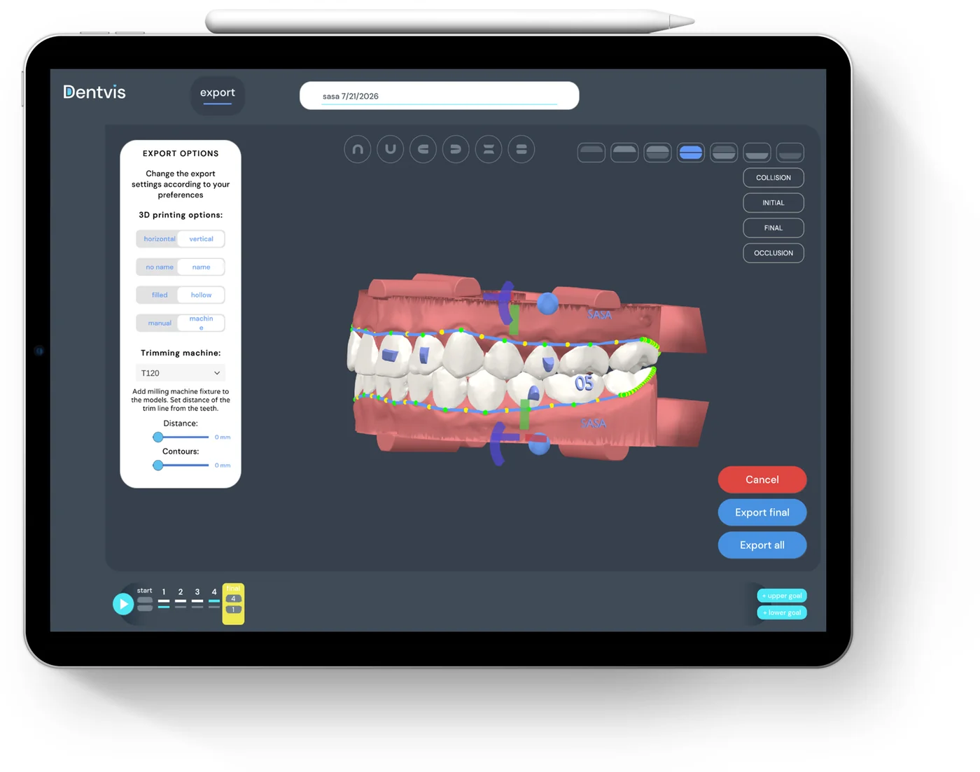 Export options for 3D printing in DentVIS on iPad